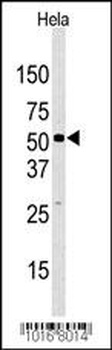 KDM4D Antibody