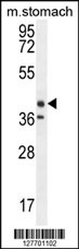 TECTB Antibody