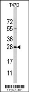 PEMT Antibody