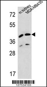 L2HGDH Antibody