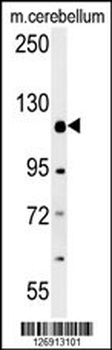 RADIL Antibody