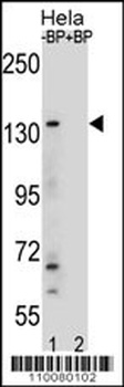 M JMJD3 Antibody
