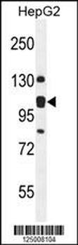 EMC1 Antibody
