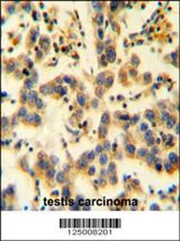 EMC1 Antibody
