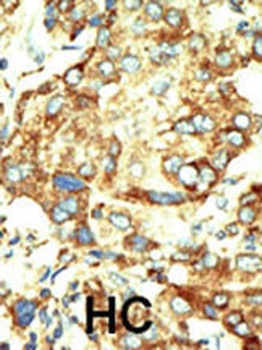 TRDMT1 Antibody