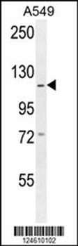 GABBR2 Antibody