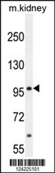 MED25 Antibody