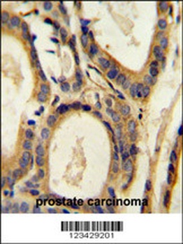 CCL4 Antibody