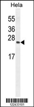 TIMP4 Antibody
