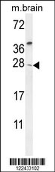 TIMP4 Antibody