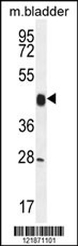 CCNY Antibody