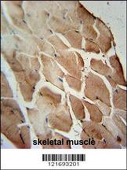 ACOT11 Antibody