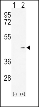 ADH4 Antibody
