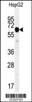 IGF2BP2 Antibody