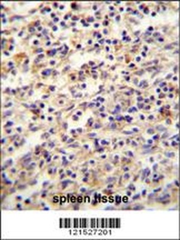 IGF2BP2 Antibody