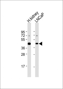 AMACR Antibody