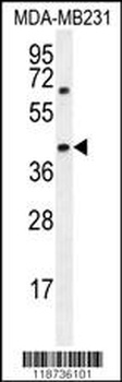 AMACR Antibody