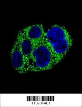 AMACR Antibody