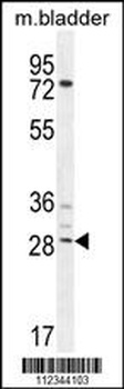 BCA3 Antibody