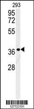 LGALS9B Antibody