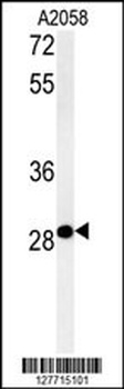 C11orf46 Antibody