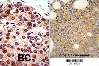 PRMT3 Antibody