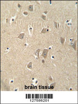 KIAA1680 Antibody