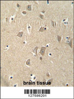 CCSER1 Antibody