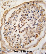 NPTX2 Antibody