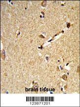 DLL3 Antibody