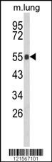 GC Antibody