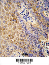 GC Antibody