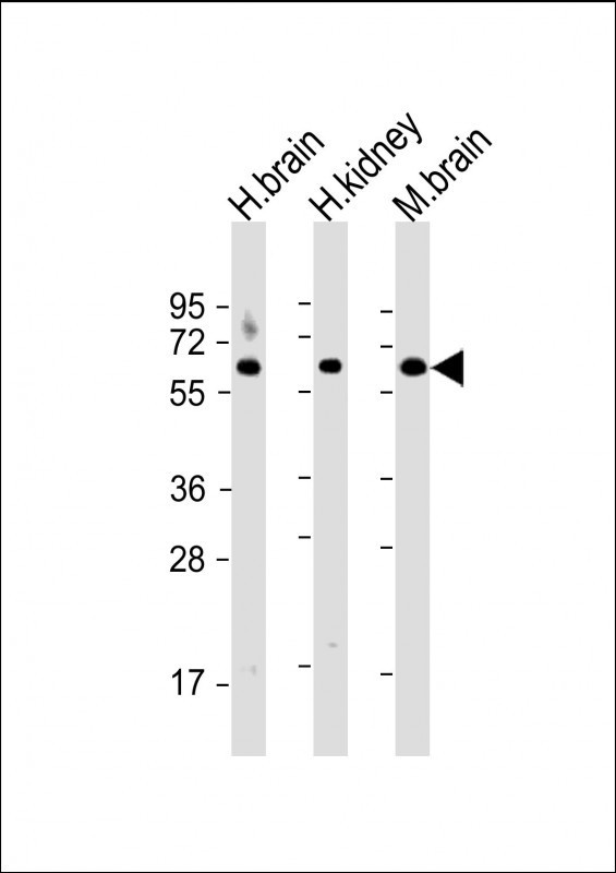 GLS Antibody