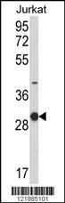 KLRC1 Antibody