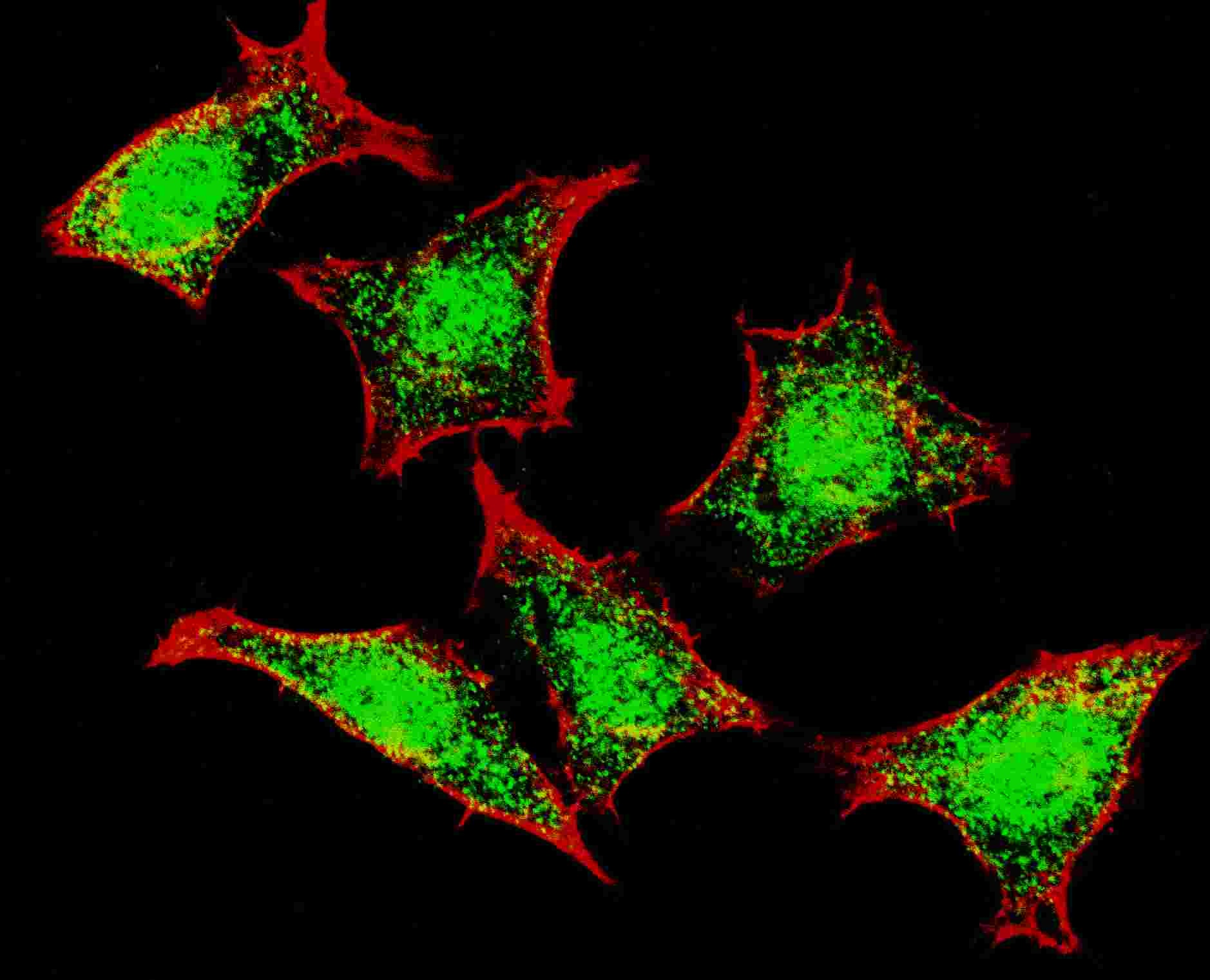 Natriuretic Peptide Receptor C Antibody