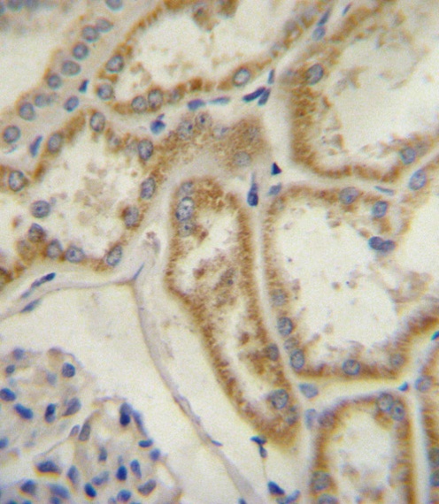 Natriuretic Peptide Receptor C Antibody