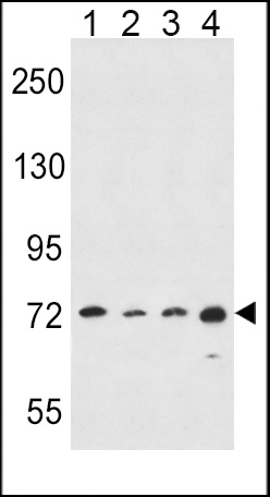ALOX15 Antibody