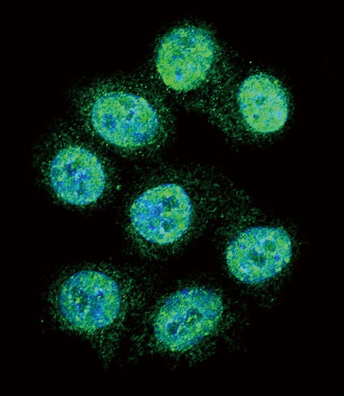 ALOX15 Antibody