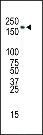 INSR Antibody