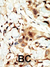 INSR Antibody