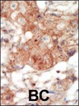 EPHA4 Antibody