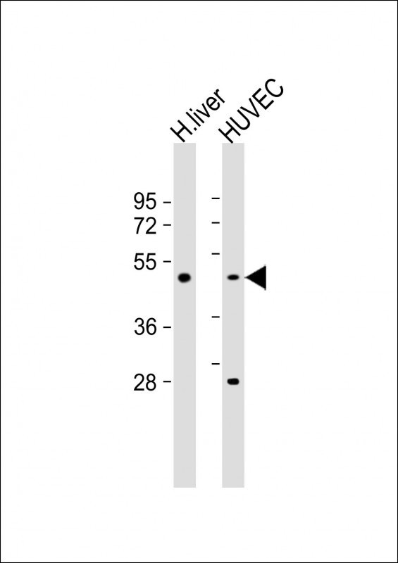 SPHK1 Antibody