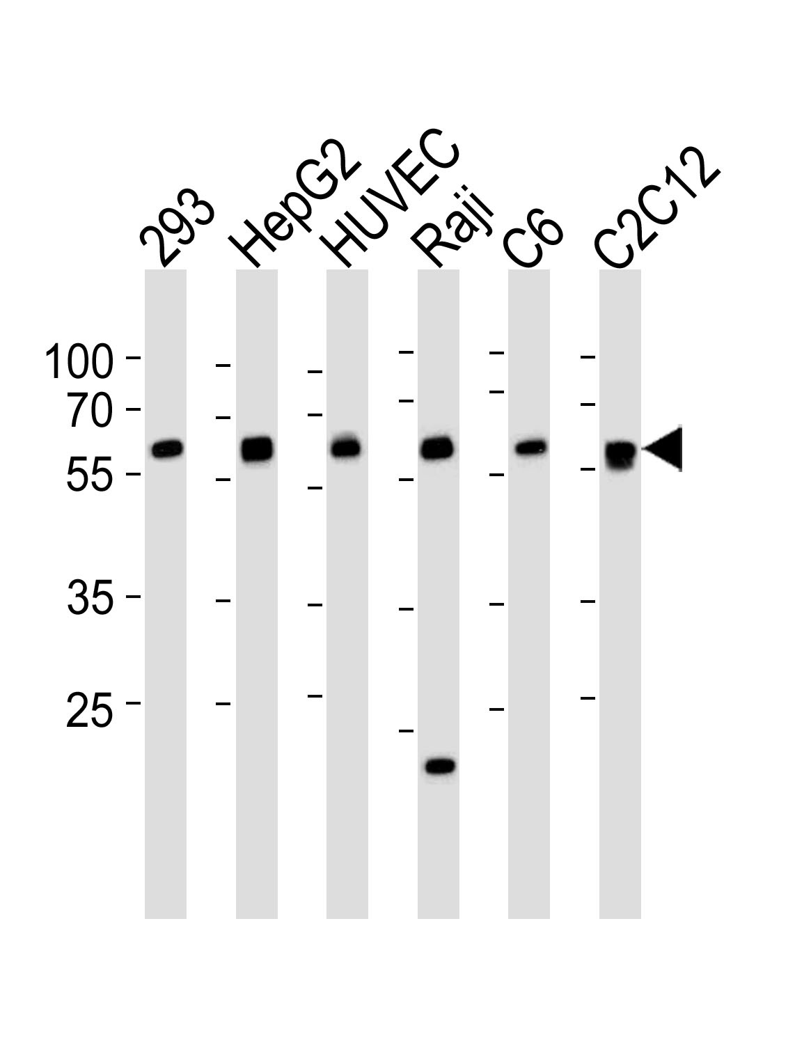 SPHK1 Antibody