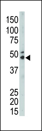 SPHK1 Antibody