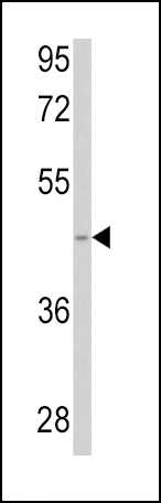 SPHK1 Antibody