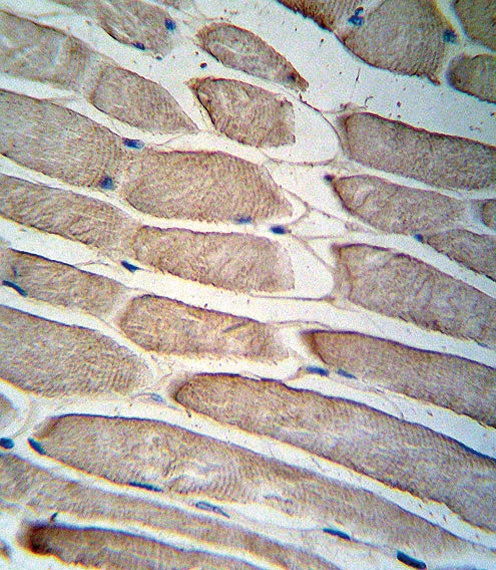 PDK4 Antibody