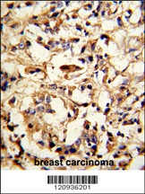 DFNA5 Antibody