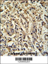 Sirt3 Antibody