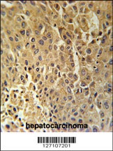 HSD17B13 Antibody