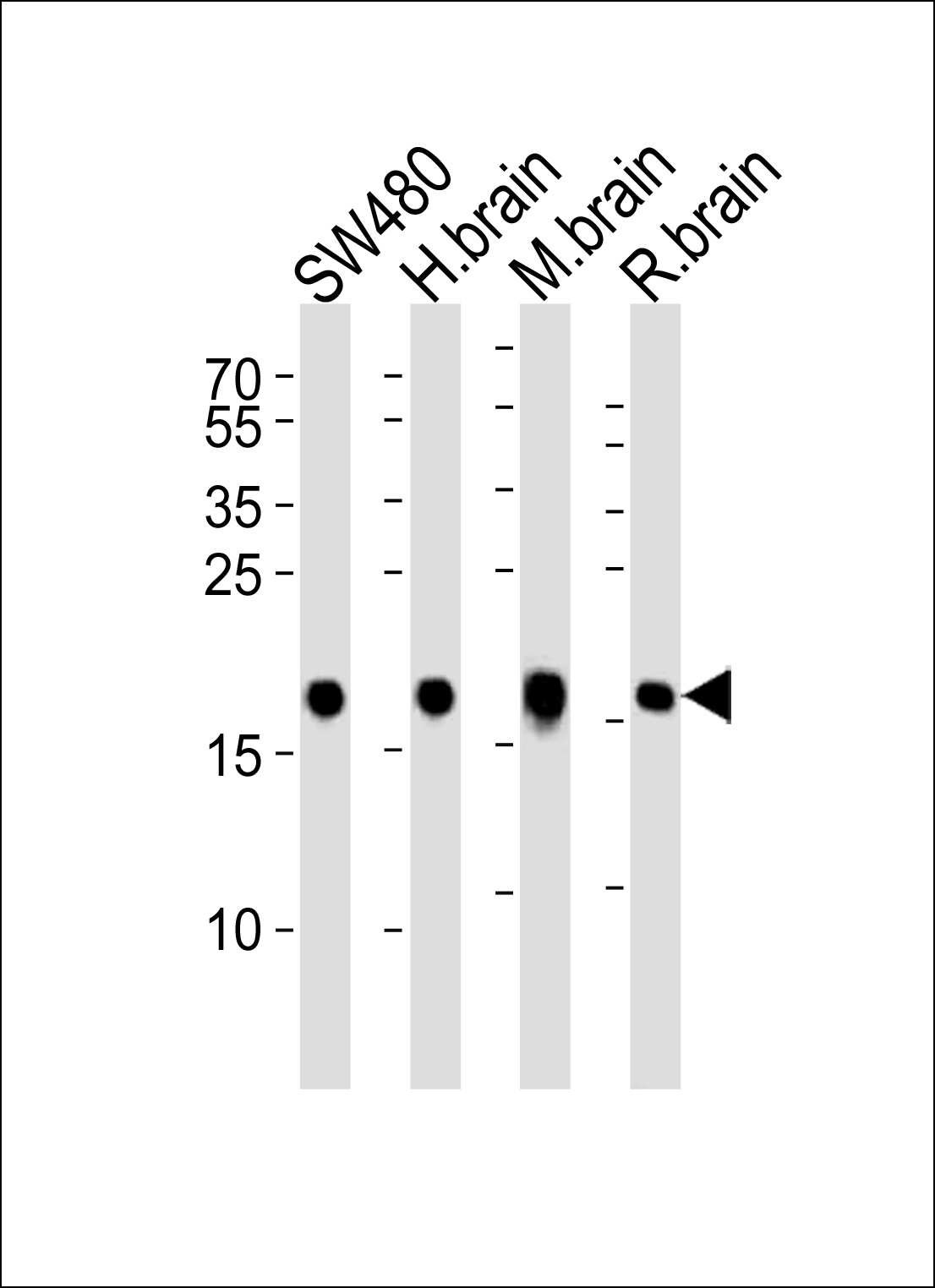 VSNL1 Antibody